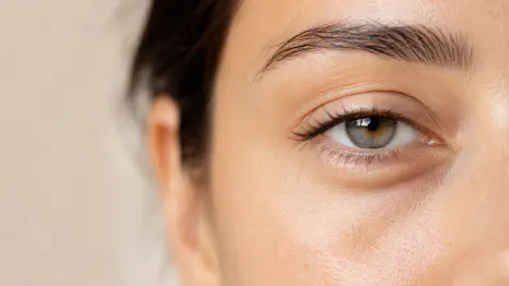 Dark Circles: What Actually Causes Them and What Helps